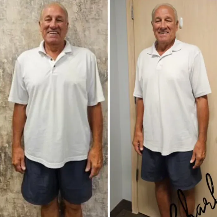 Charles J. before and after
