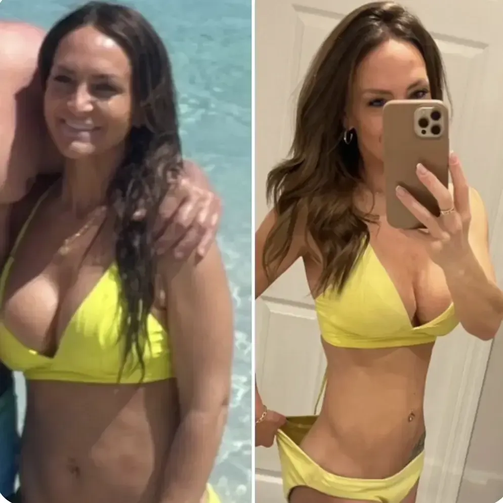 Erica R. before and after