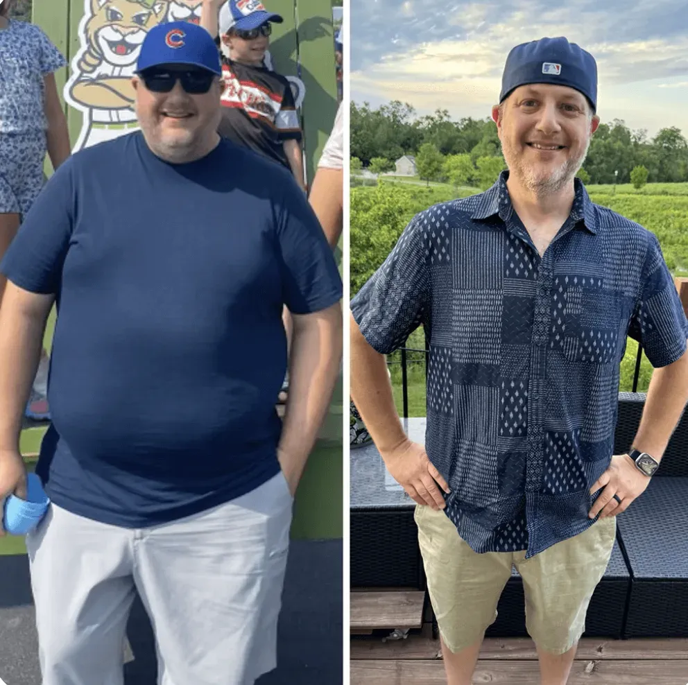 Lou L. before and after