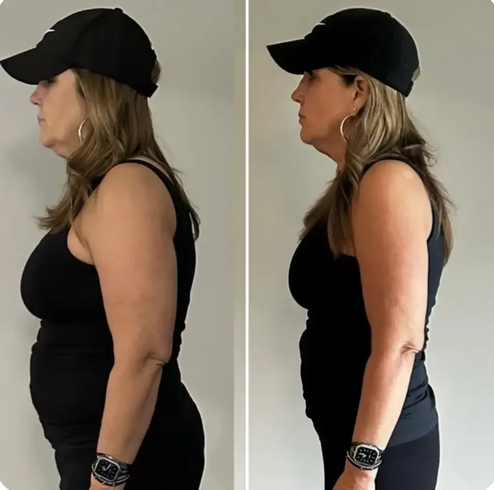 Michelle K. before and after