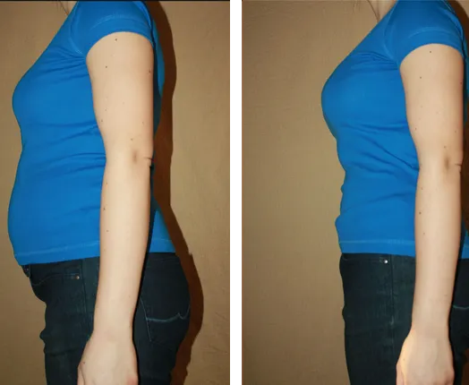 Gwen T. before and after — Lost 22 lbs & 4 dress sizes