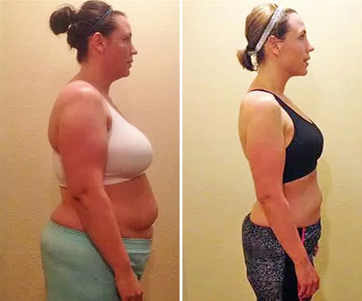 Megan L. before and after