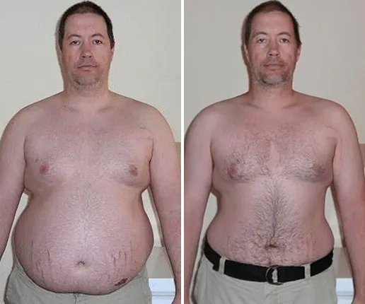Mike S. before and after