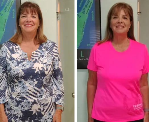 Pam B. before and after — Lost 22 lbs & 13 inches