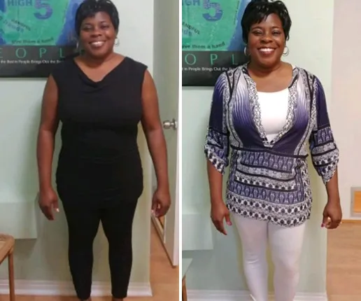 Valerie C. before and after