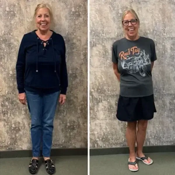 Sandy M. before and after